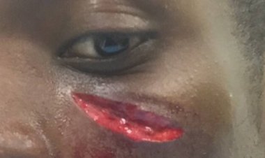 Sanglante blessure d’Onuoha