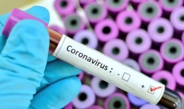 Covid-19 : le nombre de cas confirmés passe à 1 710, dont 09 décès au total