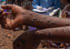 Guinée : plusieurs districts enfin débarrassés de la mpox, de la dengue et de la fièvre de Lassa
