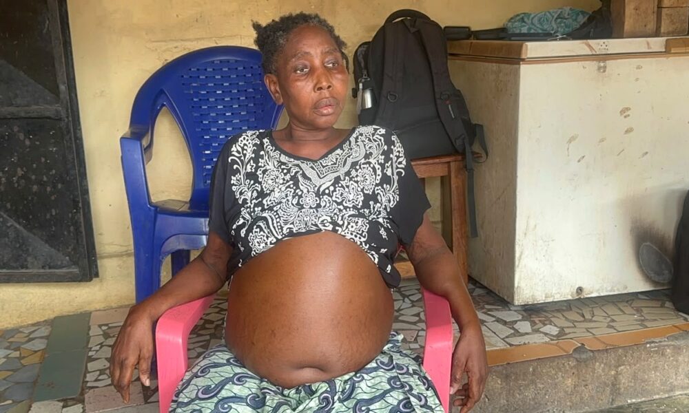 M’Mah Kaba, habitante de Khabitayah, sollicite une aide financière pour poursuivre ses soins