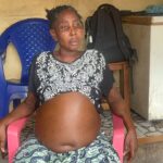 M’Mah Kaba, habitante de Khabitayah, sollicite une aide financière pour poursuivre ses soins