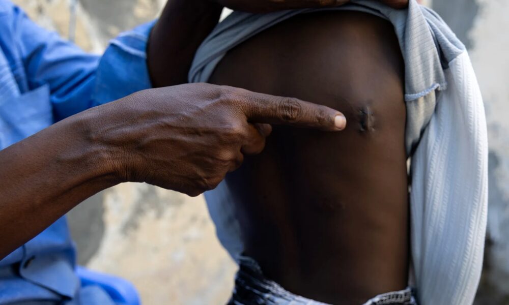 Habitants déplacés après les combats autour de Jamaame, dans le sud de la Somalie