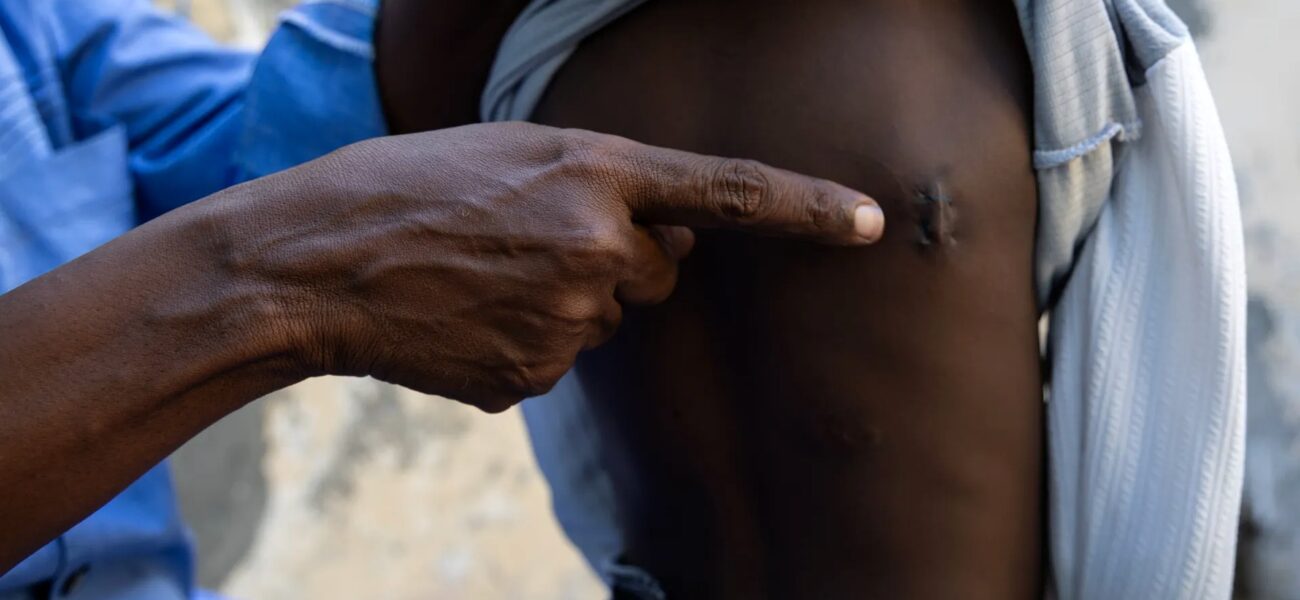 Habitants déplacés après les combats autour de Jamaame, dans le sud de la Somalie
