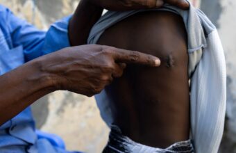 Habitants déplacés après les combats autour de Jamaame, dans le sud de la Somalie