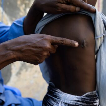 Habitants déplacés après les combats autour de Jamaame, dans le sud de la Somalie